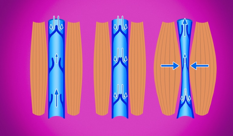 Ilustracija zdrave vene prikazuje normalno kompresijo ven, ki podpira pretok nazaj v srce